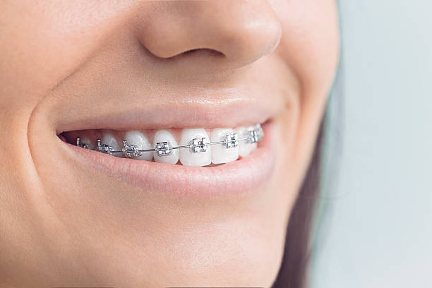 Oral Surgery in Bostonia, CA